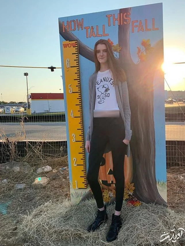 گرفتاری‌های دختری که صاحب بلندترین ساق‌های جهان است/ تصاویر